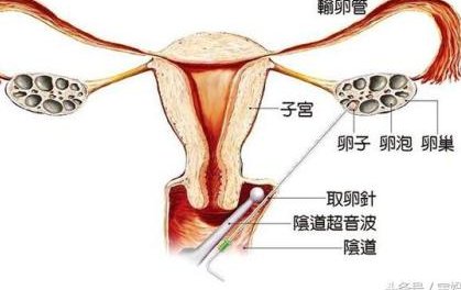 广东私立医院做试管婴儿多少钱？一次试管大概多少？