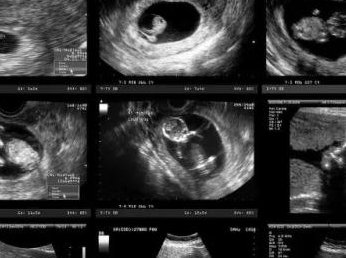 2026年山东试管婴儿费用是多少？