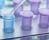 格鲁吉亚三代试管婴儿，格鲁吉亚三代试管费用